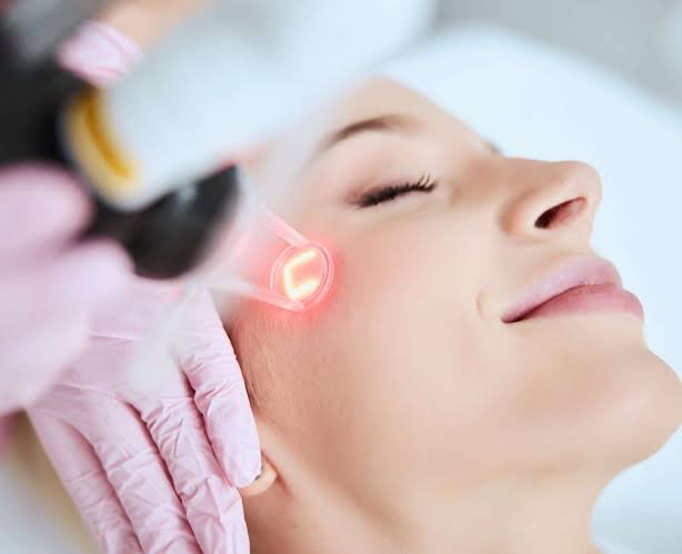 Laser Treatment 